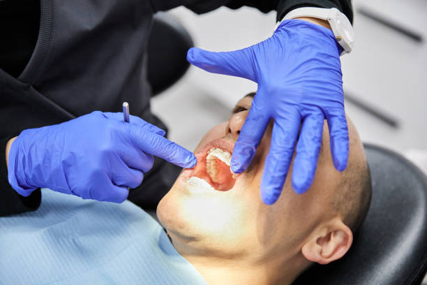 Best Emergency Dental Care for Broken or Chipped Teeth in Burnham, PA